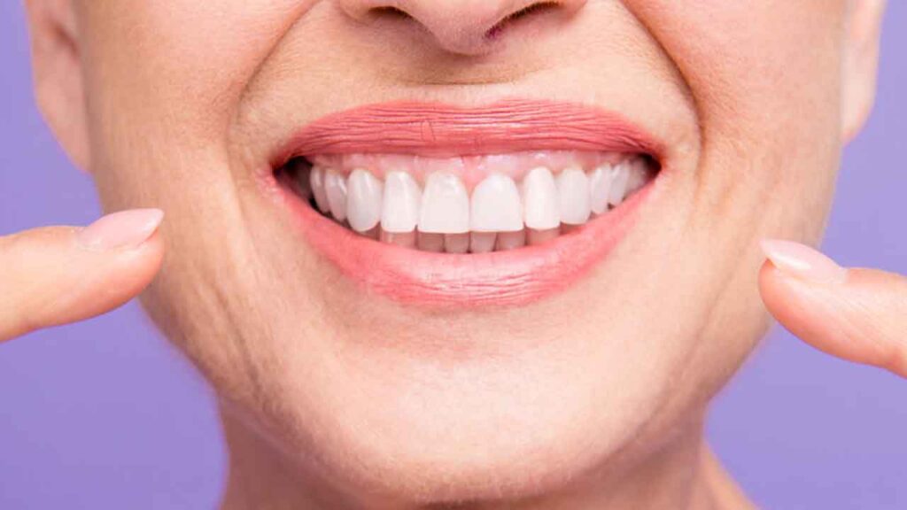 10 dúvidas sobre Invisalign respondidas aqui! - SNG Odontologia